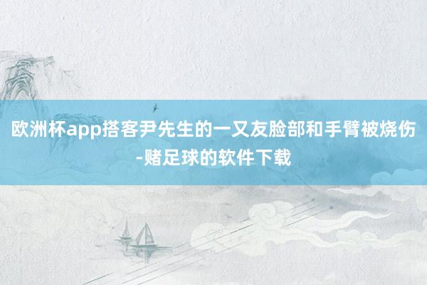 欧洲杯app搭客尹先生的一又友脸部和手臂被烧伤-赌足球的软件下载